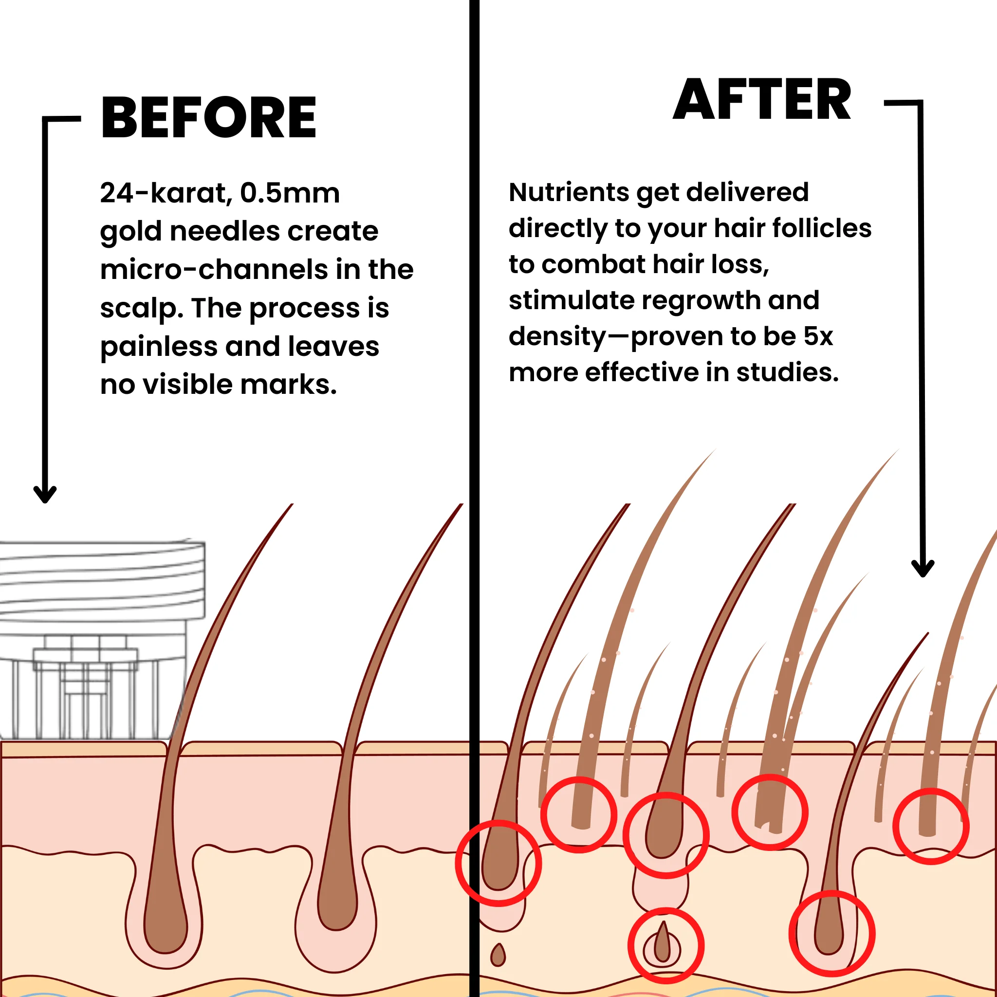 AlphaInfuse™ Hair Regrowth System - Image 2